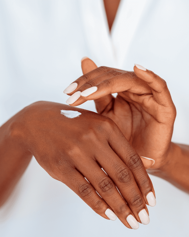 Experiencing Wedding Ring Rash? Things You Need to Know